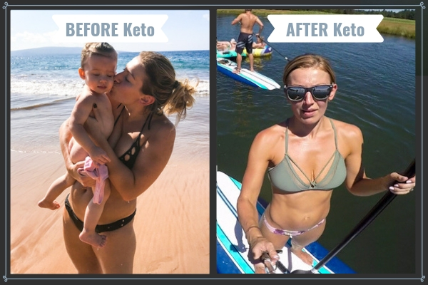Before-And-After-Keto-Pictures